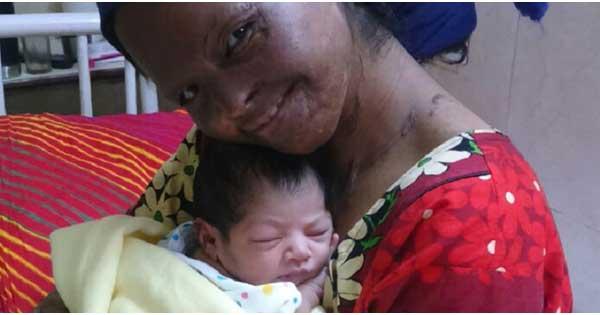 Laxmi Saas Face of Courage Laxmi Saas Face of Courage